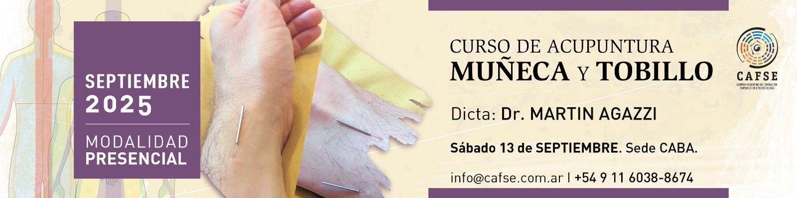 ACUPUNTURA DE MUÑECA Y TOBILLO
